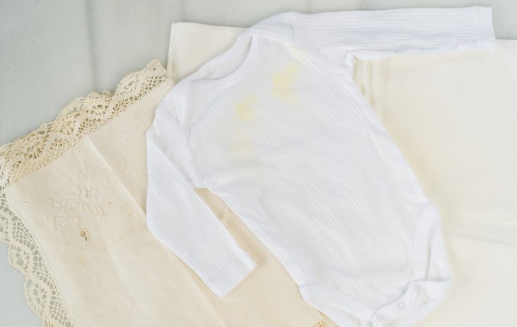 Descubrir 71+ imagen ropa blanca amarillenta